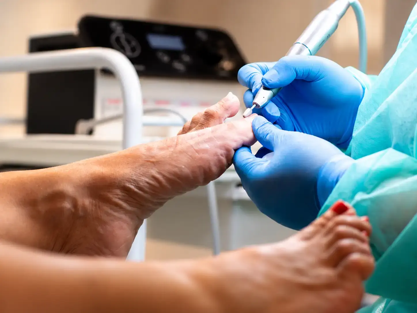 Pedicure con micromotore